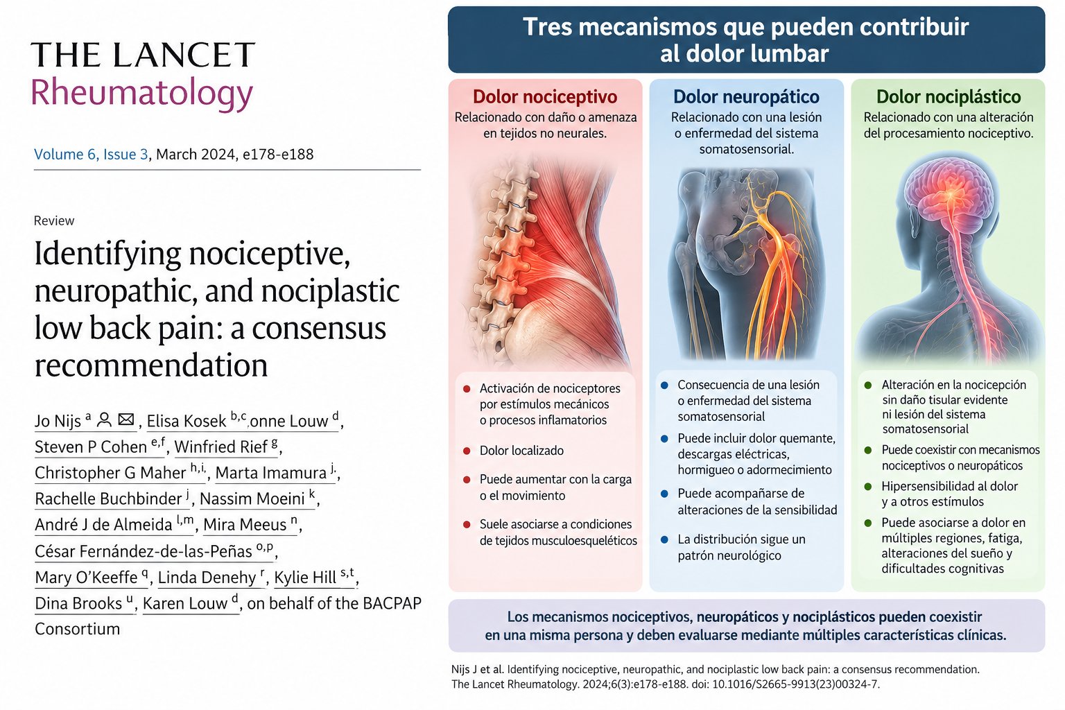 Dolor lumbar: diferencias entre dolor nociceptivo, neuropático y nociplástico