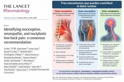 Dolor lumbar: diferencias entre dolor nociceptivo, neuropático y nociplástico